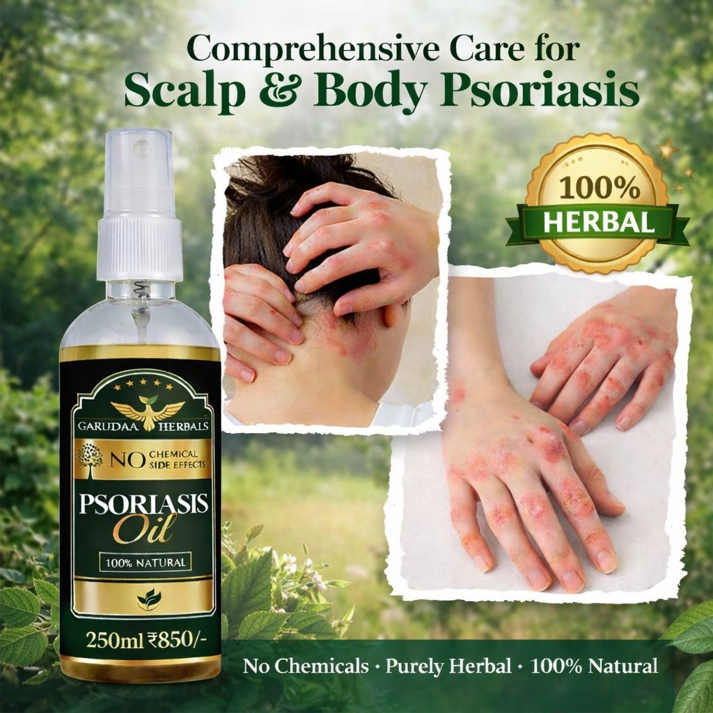 Garuda Herbal Psoriasis Oil-Advanced Psoriasis Clearing Oil